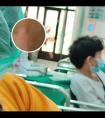 什么牌子的308光疗仪效果好