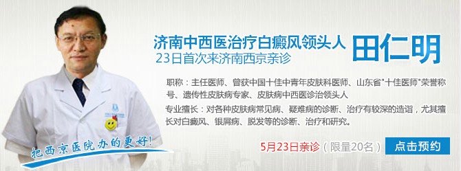 5月23日山东省皮肤病医院主任医师田仁明坐诊兰州中研白癜风医院