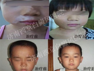暑期倒计时——兰州中研助您袪白