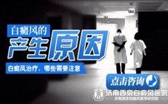 白癜风病因有哪些